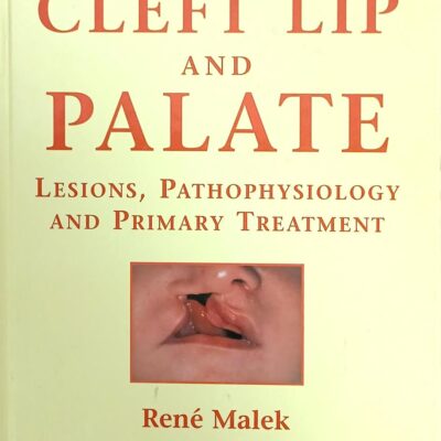 Cleft Lip And Palate Lesions Pathophysiology And Primary Treatment (Hb 2008)
