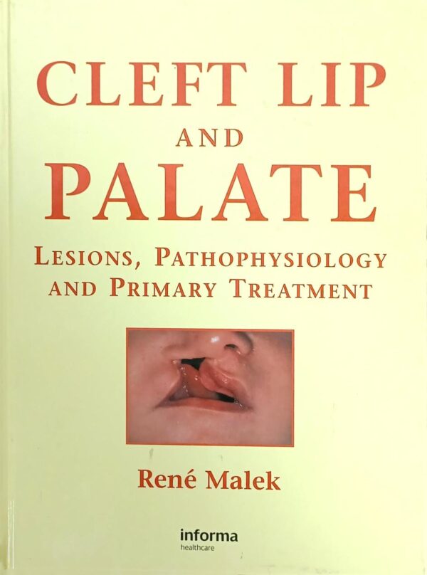 Cleft Lip And Palate Lesions Pathophysiology And Primary Treatment (Hb 2008)