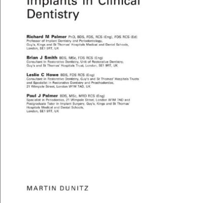 Implants in Clinical Dentistry