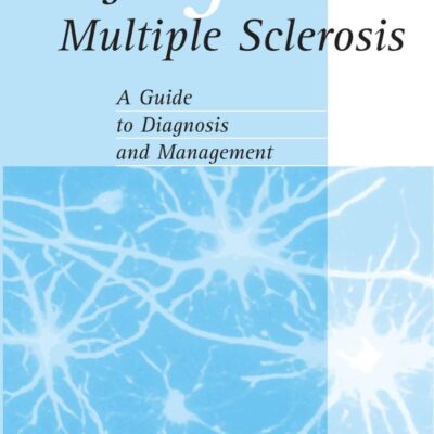 Fatigue in Multiple Sclerosis
