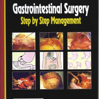 Gastrointestinal Surgery