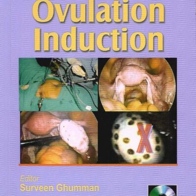 Step By Step Ovulation Induction Pb