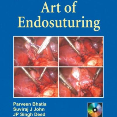 Step By Step Art Of Endosutuing Pb