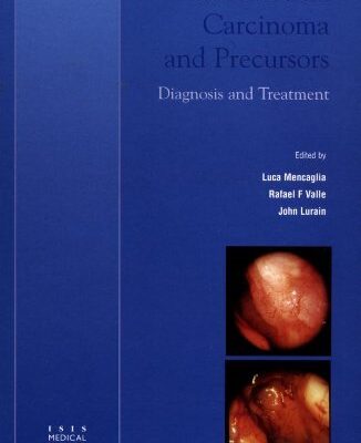 Endometrial Carcinoma and Precursors: Diagnosis and Treatment