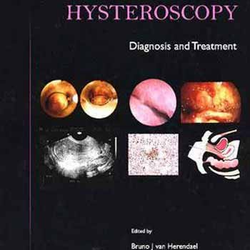 Ambulatory Hysteroscopy (Hb)