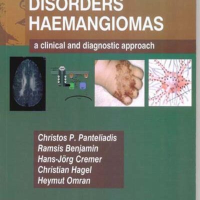 Neurocutaneous Disorders - Hemangomas: A Clinical and Diagnostic Approach