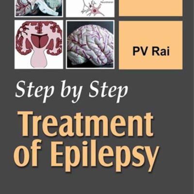 Step By Step Treatment Of Epilepsy