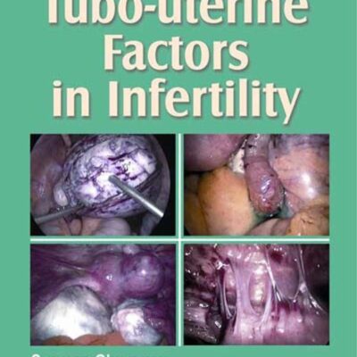 Step By Step Tubo-Uterine Factors In Infertility