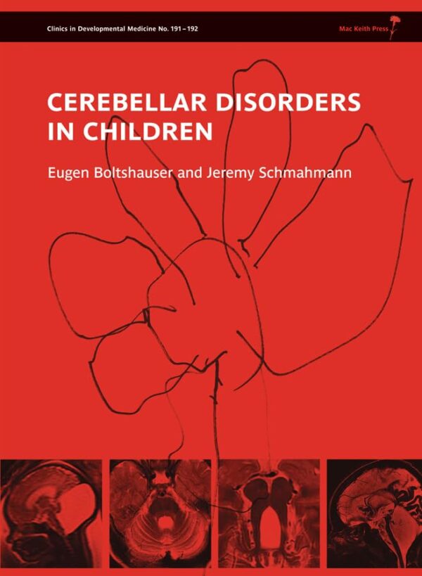 CEREBELLAR DISORDERS IN CHILDERN (HB 2012): 191 (Clinics in Developmental Medicine)
