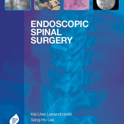 Endoscopic Spinal Surgery