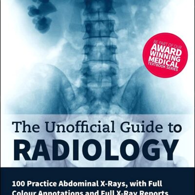 The Unofficial Guide To Radiology 100 Practice Abdominal X Rays With Full Colour Annotations And Full X Ray Reports (Pb 2020)