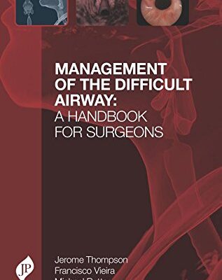 MANAGEMENT OF THE DIFFICULT AIRWAY: A HANDBOOK FOR SURGEONS