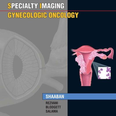 SPECIALTY IMAGING TM GYNECOLOGIC ONCOLOGY (2011) (AMIRSYS SERIES)