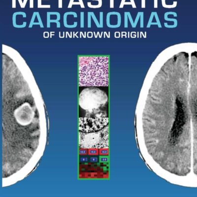 Metastatic Carcinomas of Unknown Origin