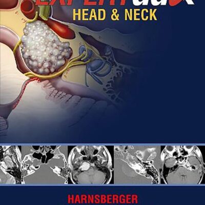 EXPERTddx: Head and Neck: Published by Amirsys (R) (EXPERTddx (TM))