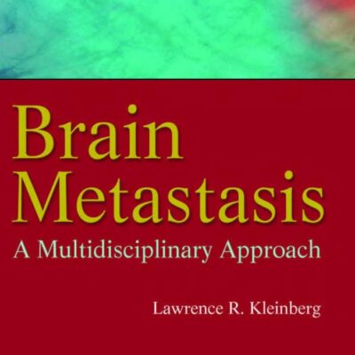 Brain Metastasis: A Multidisciplinary Approach