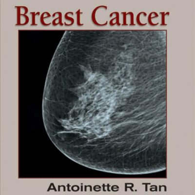 Breast Cancer (Emerging Concepts Therapeutics, 1-3)