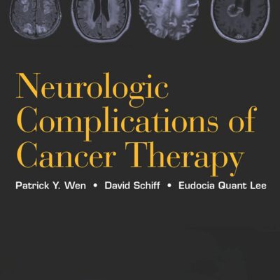 Neurologic Complications of Cancer Therapy