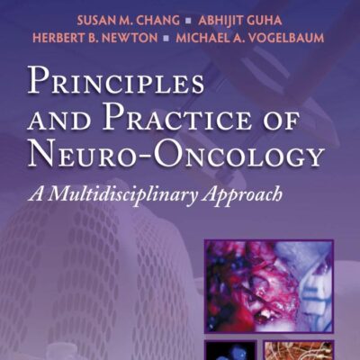 Principles & Practice of Neuro-Oncology: A Multidisciplinary Approach