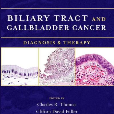 Biliary Tract and Gallbladder Cancer