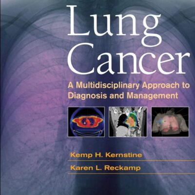Lung Cancer: A Multidisciplinary Approach to Diagnosis and Management (Current Multidisciplinary Oncology)