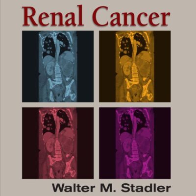 Renal Cancer (Emerging Cancer Therapeutics)