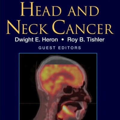 Head and Neck Cancer
