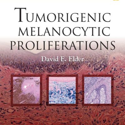 Tumorigenic Melanocytic Proliferations (Consultant Pathology Series)