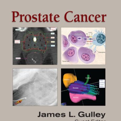 Prostate Cancer: 2 (Emerging Cancer Therapeutics)