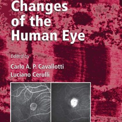 AGE-RELATED CHANGES OF THE HUMAN EYE (HB)