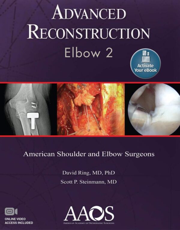 ADVANCED RECONSTRUCTION ELBOW 2 AMERICAN SHOULDER AND ELBOW SURGEONS (HB 2016) (AAOS - American Academy of Orthopaedic Surgeons)
