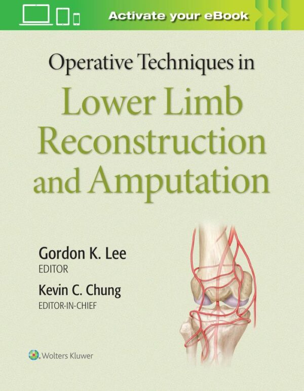 OPERATIVE TECHNIQUES IN LOWER LIMB RECONSTRUCTION AND AMPUTATION (HB 2020)