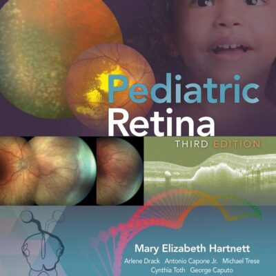 PEDIATRIC RETINA 3ED (HB 2021)