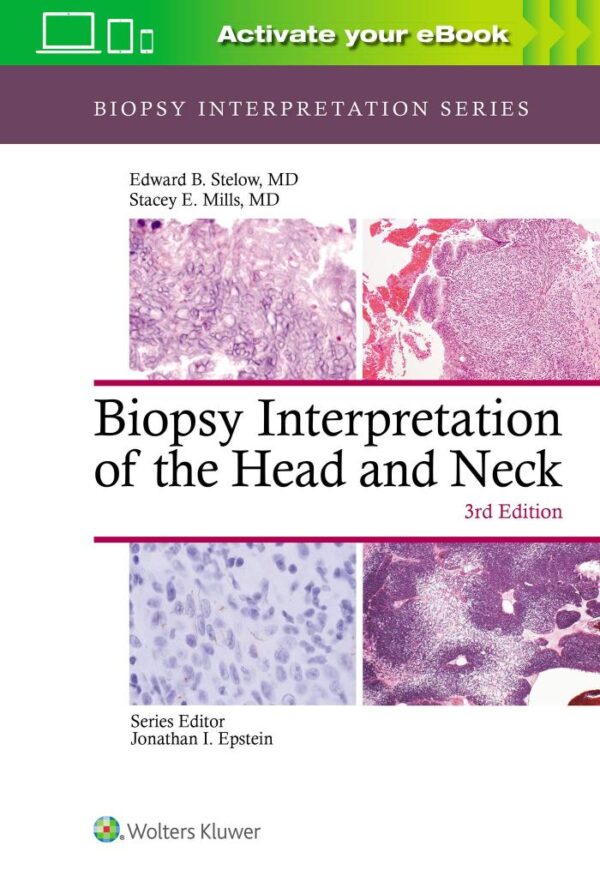 BIOPSY INTERPRETATION OF THE HEAD AND NECK 3ED (HB 2021)