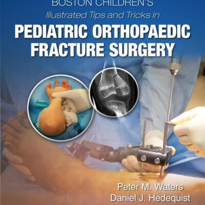 BOSTON CHILDRENS ILLUSTRATED TIPS AND TRICKS IN PEDIATRIC ORTHOPAEDIC FRACTURE SURGERY (HB 2020)