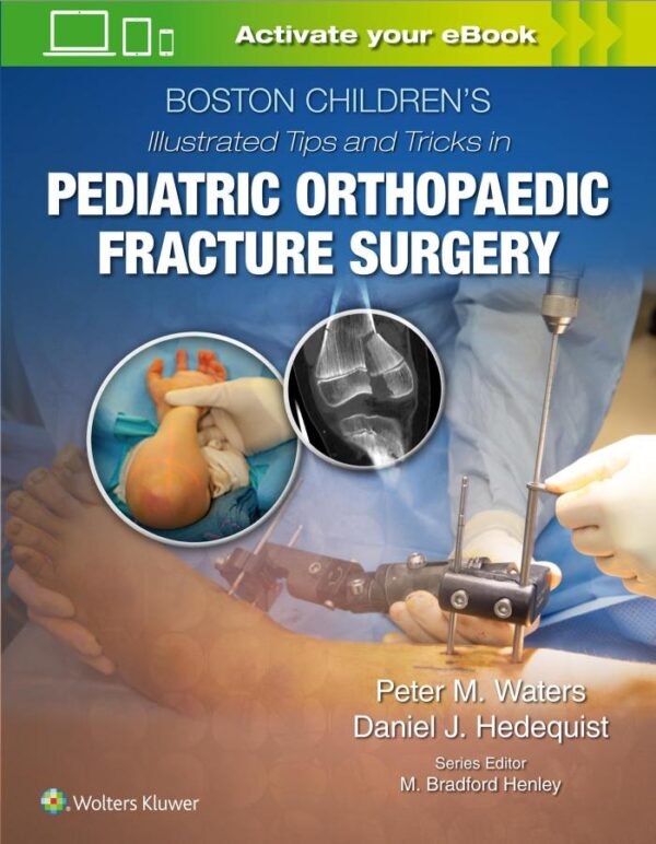 BOSTON CHILDRENS ILLUSTRATED TIPS AND TRICKS IN PEDIATRIC ORTHOPAEDIC FRACTURE SURGERY (HB 2020)