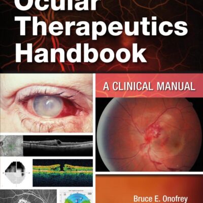 Ocular Therapeutics Handbook A Clinical Manual 4Ed (Pb 2020)