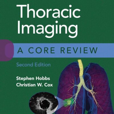 Thoracic Imaging A Core Review 2Ed (Pb 2021)