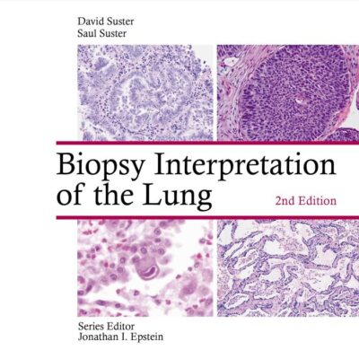 Biopsy Interpretation of the Lung (Biopsy Interpretation Series)