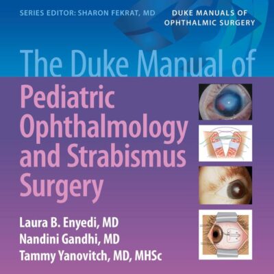 THE DUKE MANUAL OF PEDIATRIC OPHTHALMOLOGY AND STRABISMUS SURGERY (PB 2021)