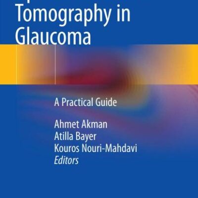 Optical Coherence Tomography in Glaucoma: A Practical Guide