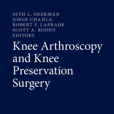 Knee Arthroscopy and Knee Preservation Surgery