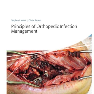 Principles Of Orthopedic Infection Management (Hb 2016)