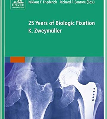 25 Years of Biologic Fixation K. Zweymuller