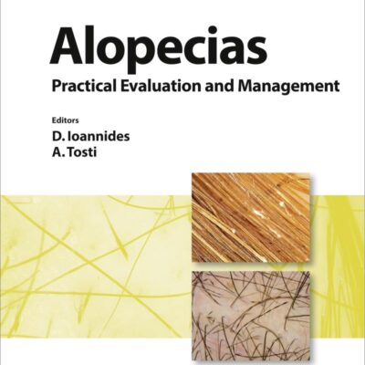 Alopecias: Practical Evaluation and Management (Current Problems in Dermatology)