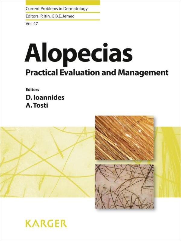 Alopecias: Practical Evaluation and Management (Current Problems in Dermatology)