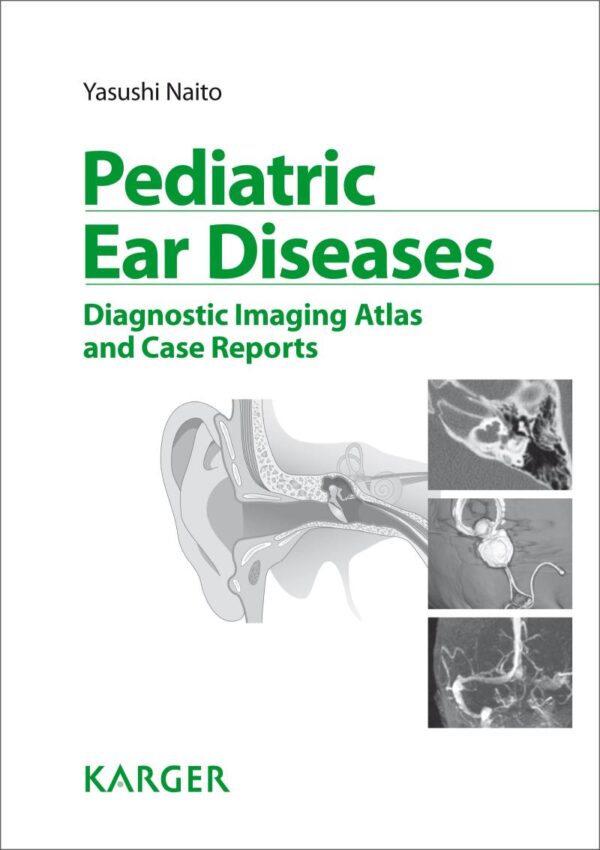Pediatric Ear Diseases: Diagnostic Imaging Atlas and Case Reports (Karger Ebooks Non-serials Collection 2013)