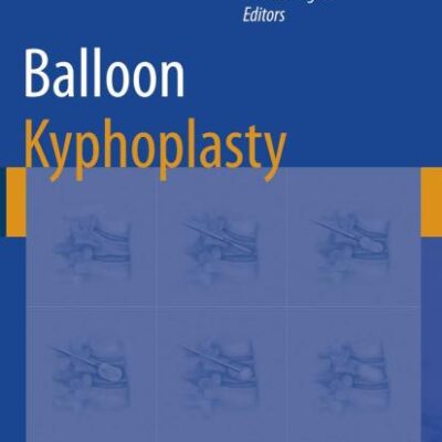 Balloon Kyphoplasty