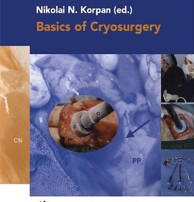 Basic of Cryosurgery