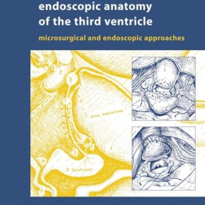 ENDOSCOPIC ANATOMY OF THE THIRD VENTRICLE (HB): Microsurgical and Endoscopic Approaches